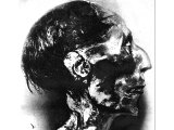 Head of the Mummy of Ramesses II, 19th Dynasty, c. 1280 BC